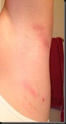 IM Racine 70.3_chafing2