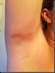 IM Racine 70.3_chafing